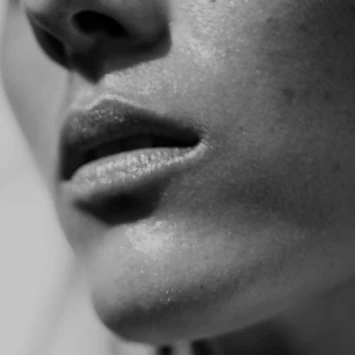 Laser genesis facial